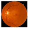 Caméra fundus OCT Revo FC